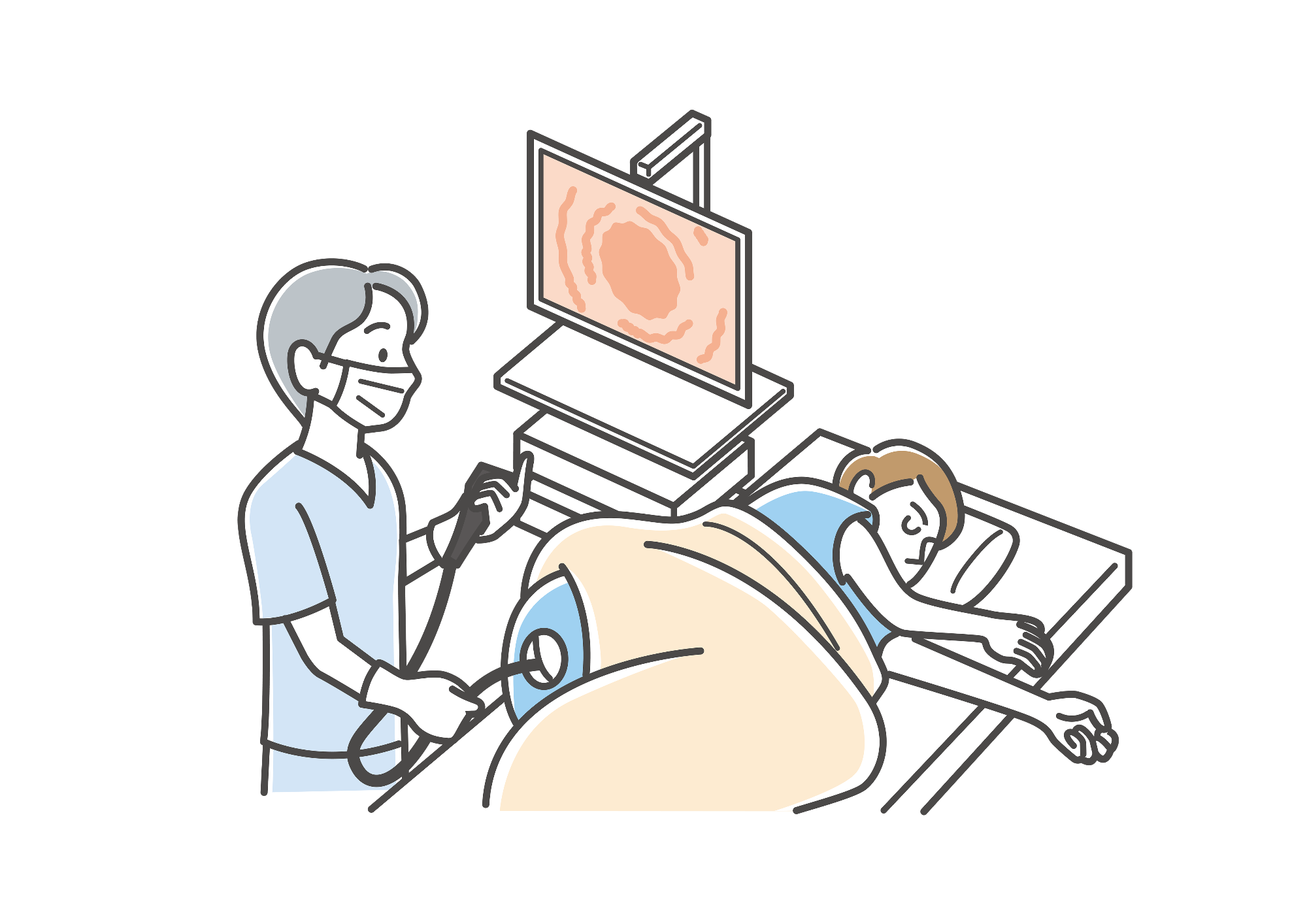 大腸内視鏡検査の画像